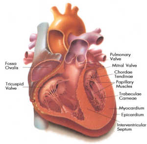 angina pectoris