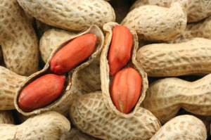 Severe Food Allergies
